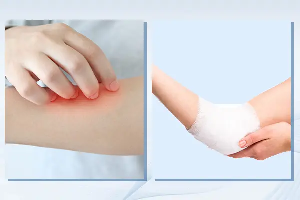 What does tranexamic acid do to your skin