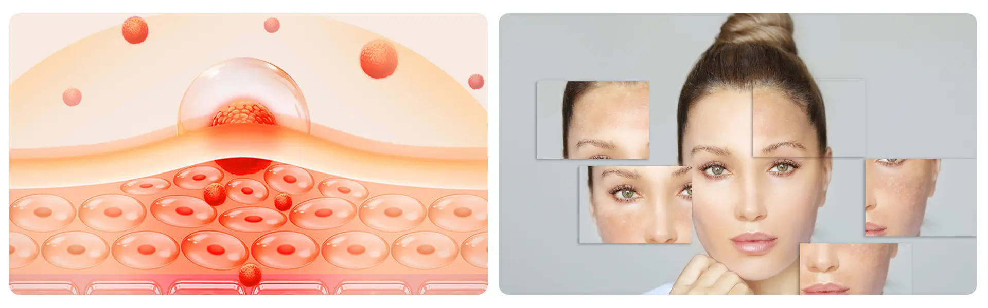 Tranexamic Acid for skin